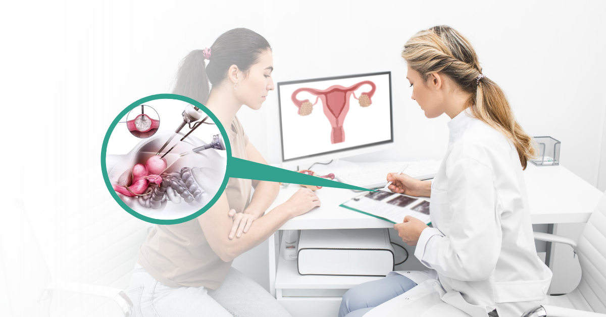 Surgical Technique Used in Fibroid Removal Surgery